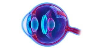 안내렌즈삽입술의 의학적 구조를 보여주는 3D 일러스트